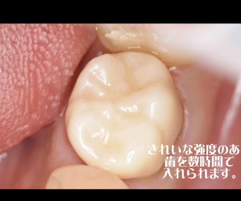 SmartSelect_20240513_225851_Instagram